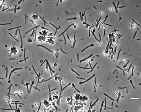 Moorella_thermoacetica-cells-in-culture-Credit-Jiang, B., Microbewiki.jpeg